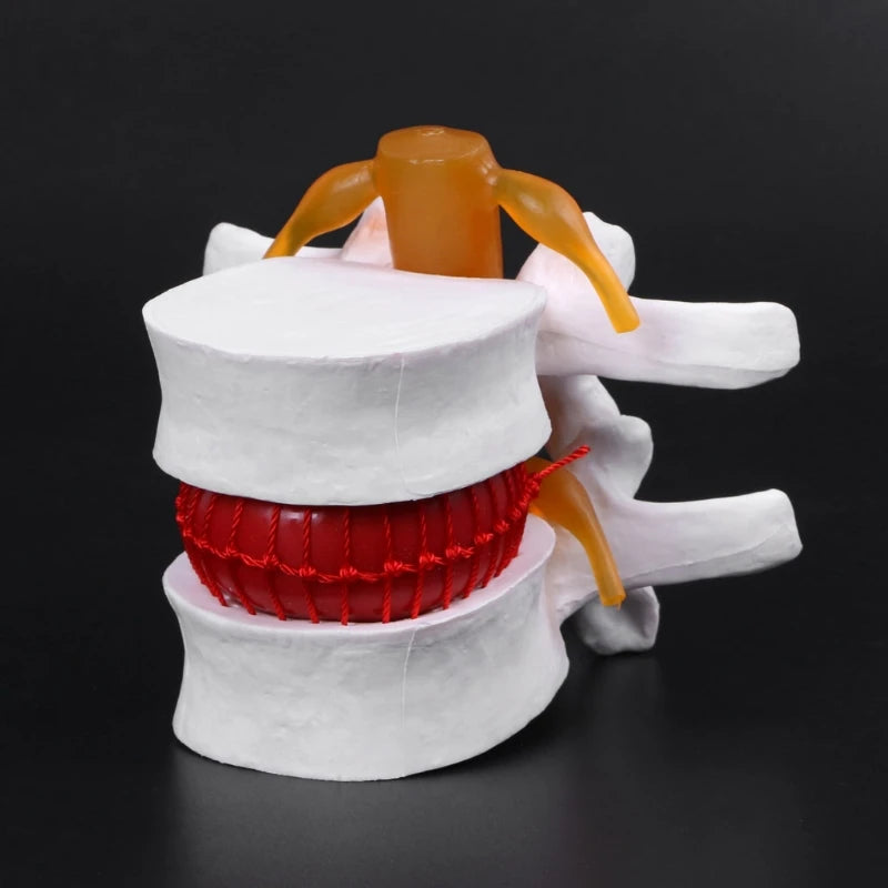 Superior Lumbar Vertebrae Model